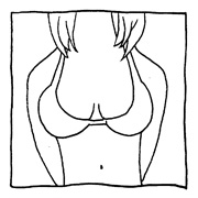 ヤングくん 寄り目