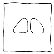 ヤングくん 私の脳はくもり